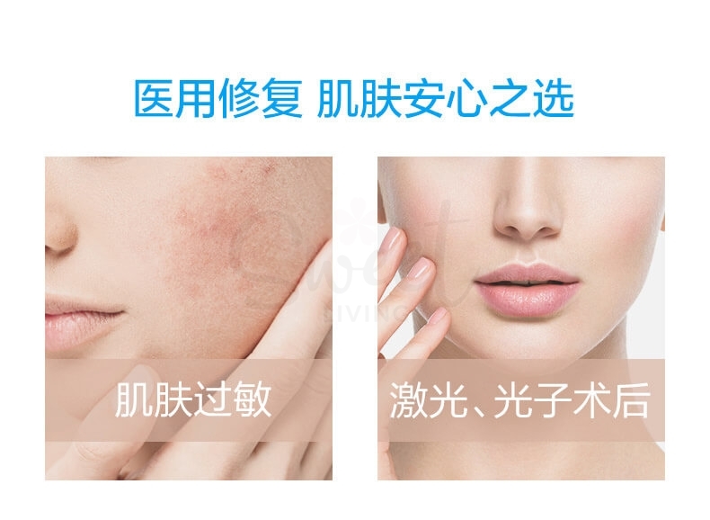 【中国 医药品牌】医美面膜 创福康 胶原蛋白医用敷料  光子嫩肤激光术后过敏修复冷敷贴 5片/盒 -  - 3@ - Sweet Living