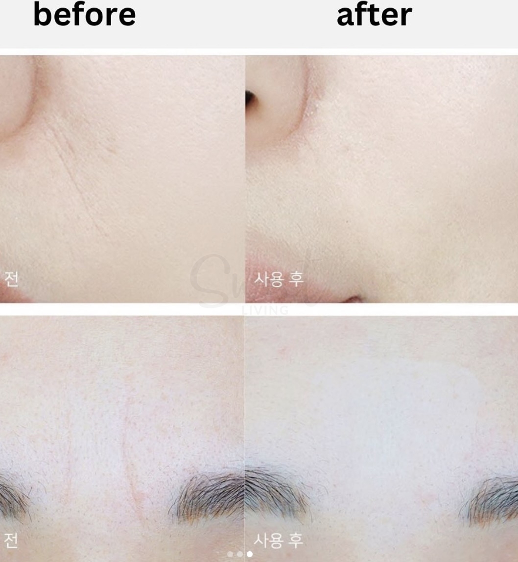 【韩国】Marshique 八字纹 川字纹 法令贴 改善皱纹细纹弹力紧致服帖 面膜 36枚 -  - 8@ - Sweet Living